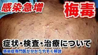 梅毒の症状 写真、検査方法、治療法、予防について【感染症専門医が詳しく解説】