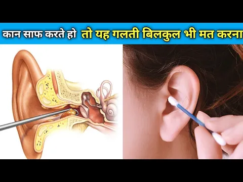 कान साफ करते हो तो यह गलती बिल्कुल मत करना #shorts