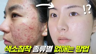 색소침착 피부 필수시청🚨 제발 한번만 이렇게 바꿔보세요... (효과 보장)