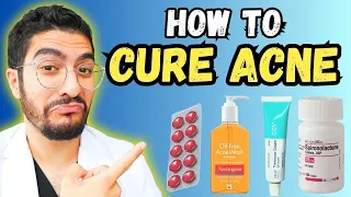 99% Overlook These Effective Acne Treatments – 2025 Guide
