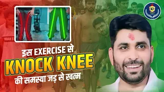 🦵 सिर्फ 3 Exercises से Knock Knees जड़ से खत्म!| 💪 असरदार Stretching Tips & 100% Solutions ✅