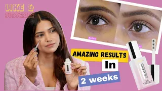 Say Goodbye to Dark Circles in 2 Weeks with L’Oréal Paris Glycolic Bright Eye Serum