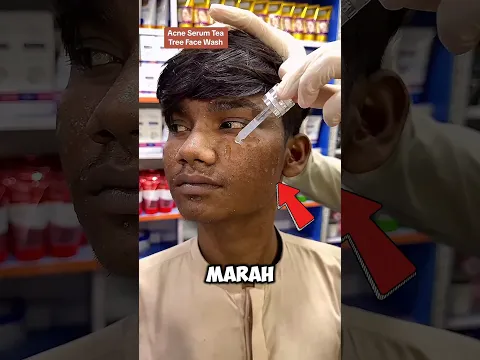 Pria ini memutuskan untuk menjadi tampan #shorts