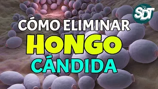 😱 Cómo ELIMINAR el HONGO CÁNDIDA 👩 3 Remedios NATURALES para COMBATIR la cándida albicans ♀️♂️