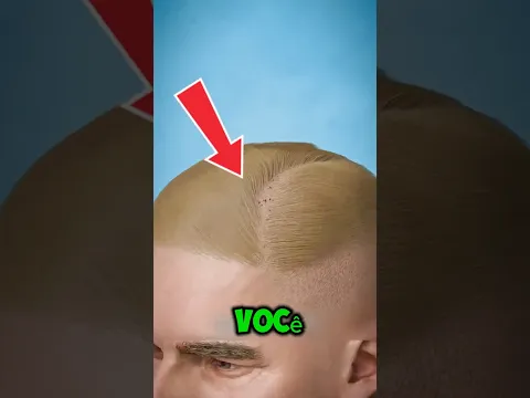 POR QUE OS PIOLHOS CAUSAM COCEIRA NA CABEÇA