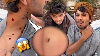 कीड़ों का क़हर 🥲 #vlog #newvlog #viral 