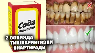 САРГАЙГАН ТИШЛАРНИ ОКАРТИРАМИЗ🦷2 СОНИЯДА ДУРДЕК ОППОК ТИШЛАРГА ЭГА БУЛАСИЗ💎
