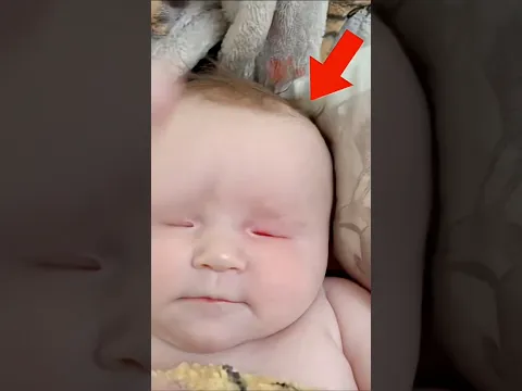 anak ini tidak bisa melihat dunia🥹