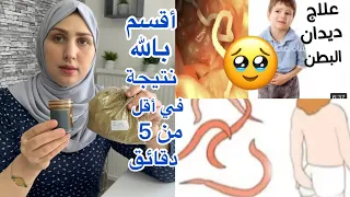 وصفة سحرية لعلاج ديدان البطن أقسم بالله نتيجة في أقل من 5 دقائق
