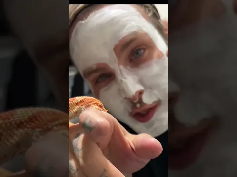 How to survive Hognose Snake bite! When #selfcare goes wrong lol my girlfriend made me do it 💅