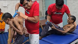Ankylosing Spondylitis Treatment.
