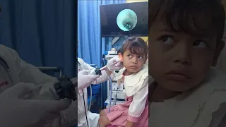 ENT Doctor with Young Patient 👶✨ | Ear & Nose Checkup #MedicalVideo #ENTCare