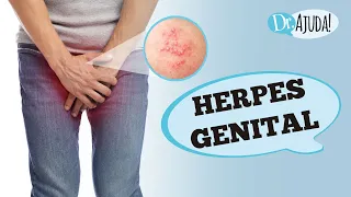 HERPES GENITAL – O QUE É, SINTOMAS, TRATAMENTOS?