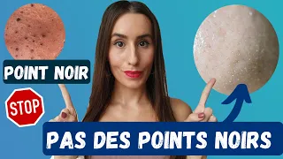 TU N'AS PROBABLEMENT PAS DE POINTS NOIRS SUR LE NEZ - COMMENT DIMINUER LES FILAMENTS SÉBACÉS ?