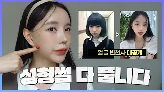 이 수술은 절대 하지마세요😤!!내가 여태껏 받은 성형수술의 모든것/눈,코,안면윤곽 수술후기, 부작용,회복기간 등등...(ENG/JPN)
