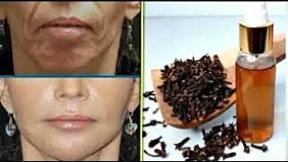 PINGOU ESTICOU/ ATÉ MINHA DERMATOLOGISTA PERGUNTOU O QUE EU USEI...