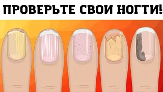 8 Вещей Которые Ваши Ногти Могут Рассказать о Вашем Здоровье